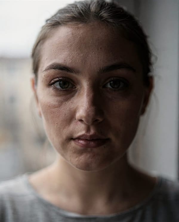 A close portrait of a young woman by a window, with visible pores and small bumps across her forehead, before and after the Skin tool: at smoothing 0.35 her skin is evener and the pores and texture are still there.